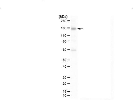 Anti-UTX (KDM6A) from rabbit, purified by affinity chromatography