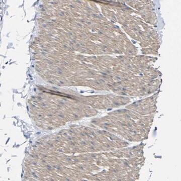 Anti-TNFAIP1 antibody produced in rabbit Prestige Antibodies&#174; Powered by Atlas Antibodies, affinity isolated antibody, buffered aqueous glycerol solution