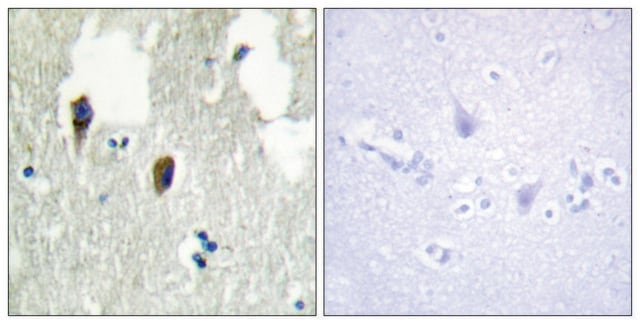 Anti-KLHL3 antibody produced in rabbit affinity isolated antibody