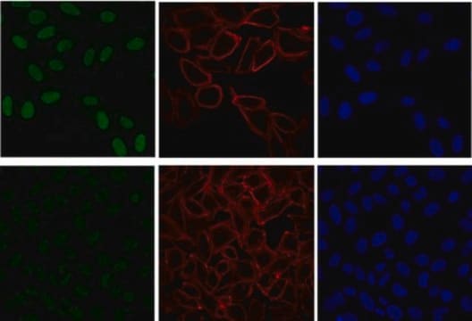 Anti-phospho-ATM (Ser1981) Antibody, clone 10H11.E12, Alexa Fluor&#8482; 488 clone 10H11.E12, from mouse, ALEXA FLUOR&#8482; 488