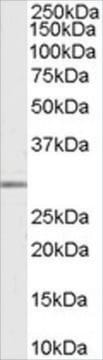 Anti-MMP7 antibody produced in goat affinity isolated antibody, buffered aqueous solution