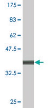 Monoclonal Anti-ATP7B, (C-terminal) antibody produced in mouse clone 3A12, purified immunoglobulin, buffered aqueous solution