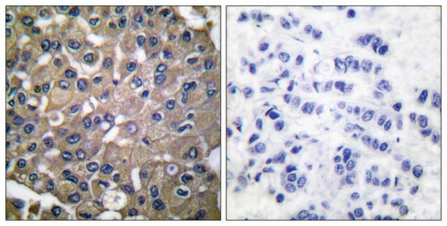 Anti-MMP-9 antibody produced in rabbit affinity isolated antibody