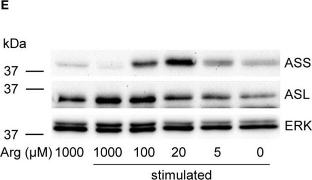 Anti-ASL antibody produced in rabbit Prestige Antibodies&#174; Powered by Atlas Antibodies, affinity isolated antibody, buffered aqueous glycerol solution