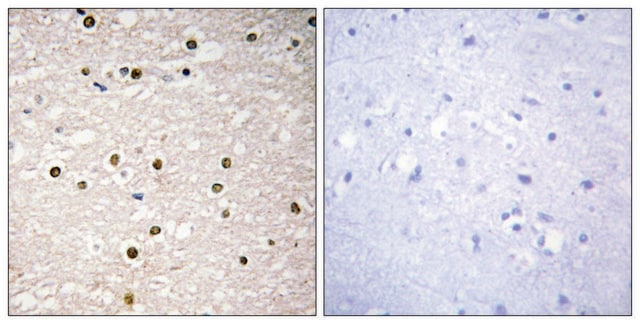 Anti-P73 antibody produced in rabbit affinity isolated antibody