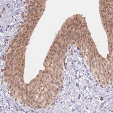 Anti-TMEM55B antibody produced in rabbit Prestige Antibodies&#174; Powered by Atlas Antibodies, affinity isolated antibody, buffered aqueous glycerol solution