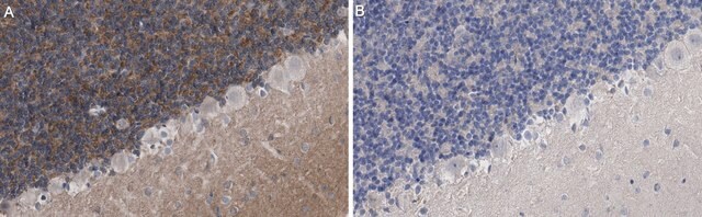 Anti-KCNT1 Antibody