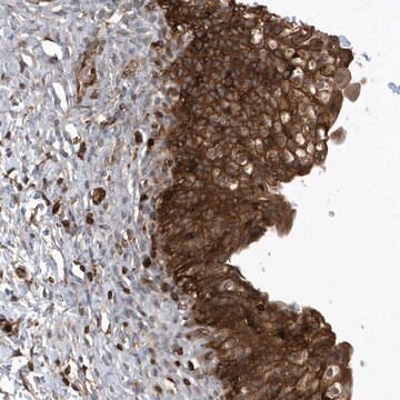 Anti-LAPTM4A antibody produced in rabbit Prestige Antibodies&#174; Powered by Atlas Antibodies, affinity isolated antibody, buffered aqueous glycerol solution