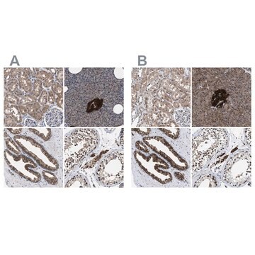 Anti-ACLY antibody produced in rabbit Prestige Antibodies&#174; Powered by Atlas Antibodies, affinity isolated antibody, buffered aqueous glycerol solution