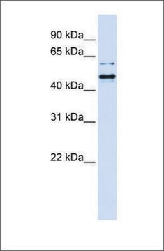 Anti-TUB (ab1) antibody produced in rabbit affinity isolated antibody