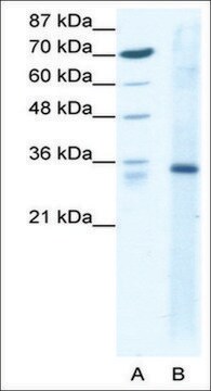 Anti-KLF3 antibody produced in rabbit IgG fraction of antiserum