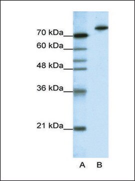 Anti-KLHL3 antibody produced in rabbit IgG fraction of antiserum