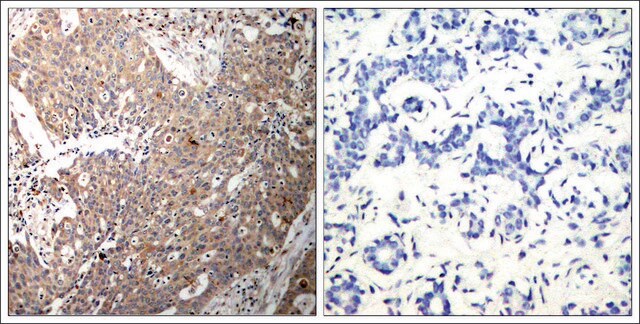 Anti-KRT18 (Ab-33) antibody produced in rabbit affinity isolated antibody