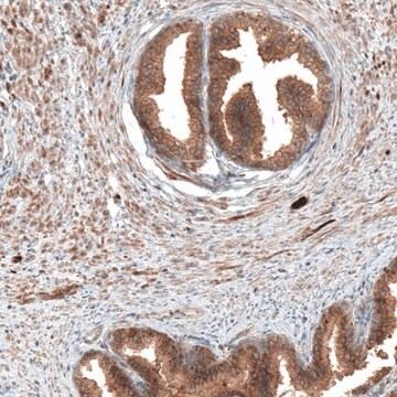 Anti-DMXL1 antibody produced in rabbit Prestige Antibodies&#174; Powered by Atlas Antibodies, affinity isolated antibody, buffered aqueous glycerol solution