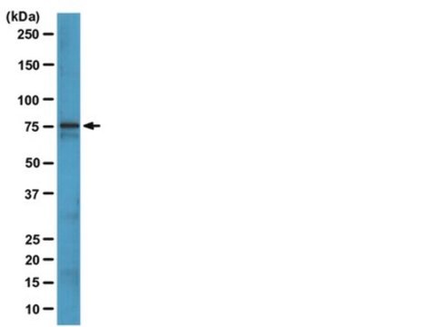 Anti-Bruton-Tyrosinkinase(BTK)-Antikörper, Klon 10D11 clone 10D11, from mouse