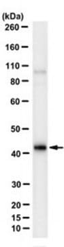 Anti-PNPLA3/Adiponutrin Antibody, clone 19A6