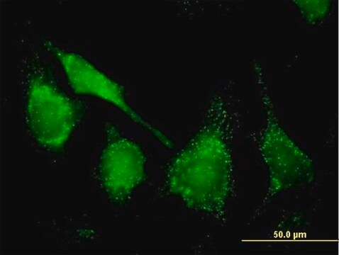 Anti-CAT antibody produced in mouse purified immunoglobulin, buffered aqueous solution