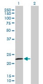 Anti-RASGEF1B antibody produced in mouse purified immunoglobulin, buffered aqueous solution