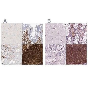 Anti-ARHGAP25 antibody produced in rabbit Prestige Antibodies&#174; Powered by Atlas Antibodies, affinity isolated antibody, buffered aqueous glycerol solution