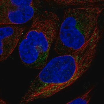 Anti-Cyb5R1 Antibody Produced In Rabbit Prestige Antibodies&#174; Powered by Atlas Antibodies, affinity isolated antibody, buffered aqueous glycerol solution