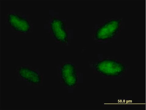 Anti-NHEJ1 antibody produced in mouse purified immunoglobulin, buffered aqueous solution