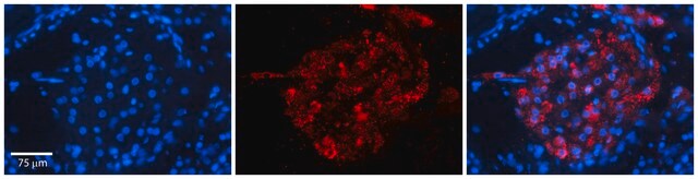 Anti-ERGIC3 antibody produced in rabbit affinity isolated antibody