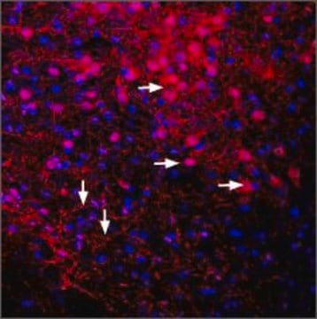 Anti-Potassium Channel KIR3.2 (GIRK2) antibody produced in rabbit affinity isolated antibody, lyophilized powder