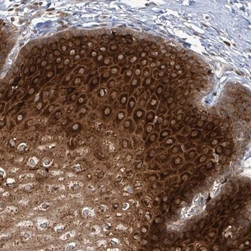 Anti-OR51E1 antibody produced in rabbit Prestige Antibodies&#174; Powered by Atlas Antibodies, affinity isolated antibody, buffered aqueous glycerol solution