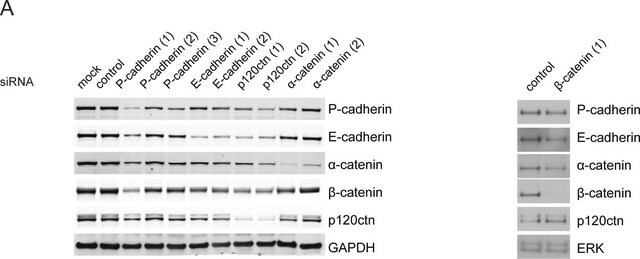 Anti-&#946;-Catenin antibody produced in rabbit whole antiserum