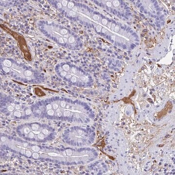 Anti-SMIM9 antibody produced in rabbit Prestige Antibodies&#174; Powered by Atlas Antibodies, affinity isolated antibody, buffered aqueous glycerol solution