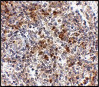 Anti-OCC-1 (ab2) antibody produced in rabbit affinity isolated antibody, buffered aqueous solution