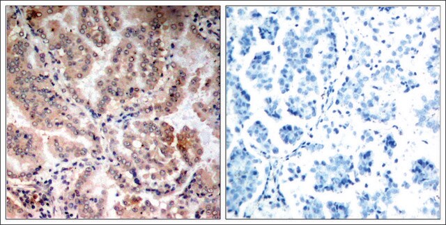 Anti-PRKAA1/PRKAA2 (Ab-174/172) antibody produced in rabbit affinity isolated antibody