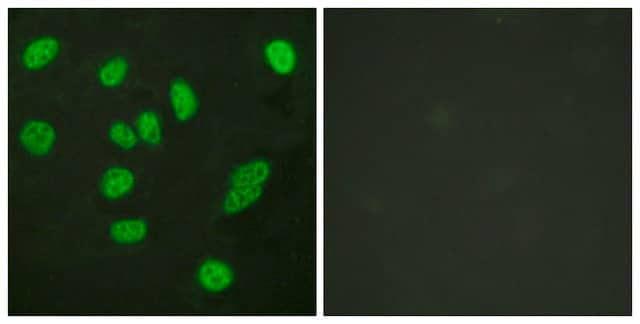 Anti-B-MYB antibody produced in rabbit affinity isolated antibody