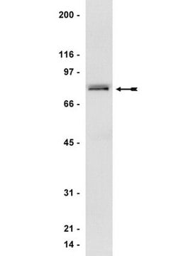 Anticuerpo anti-GRK 2/3 (&#946;ARK 1/2), clon C5/1.1 clone C5/1.1, Upstate&#174;, from mouse