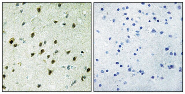 Anti-MAD4 antibody produced in rabbit affinity isolated antibody