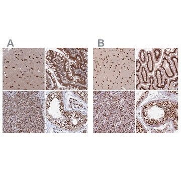 Anti-CTB-50L17.10 antibody produced in rabbit Prestige Antibodies&#174; Powered by Atlas Antibodies, affinity isolated antibody, buffered aqueous glycerol solution