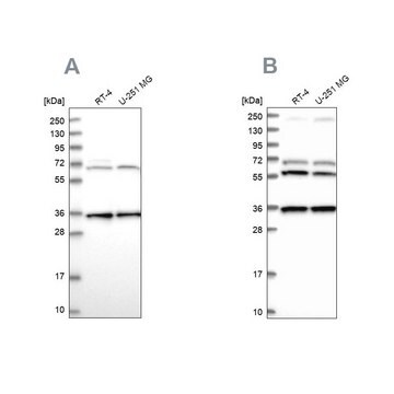 Anti-DNAJC17 antibody produced in rabbit Prestige Antibodies&#174; Powered by Atlas Antibodies, affinity isolated antibody, buffered aqueous glycerol solution