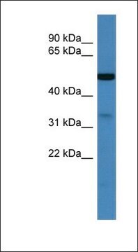 Anti-ZDHHC3 antibody produced in rabbit affinity isolated antibody