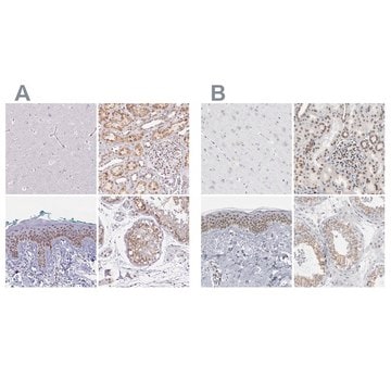 Anti-SYNE2 antibody produced in rabbit Prestige Antibodies&#174; Powered by Atlas Antibodies, affinity isolated antibody, buffered aqueous glycerol solution