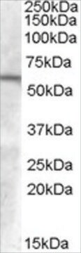 Anti-GCNT3 (AA 410-422) antibody produced in goat affinity isolated antibody, buffered aqueous solution