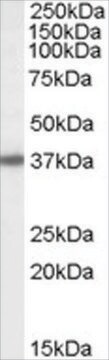 Anti-Bisphosphate 3&#8242;-nucleotidase antibody produced in goat affinity isolated antibody, buffered aqueous solution