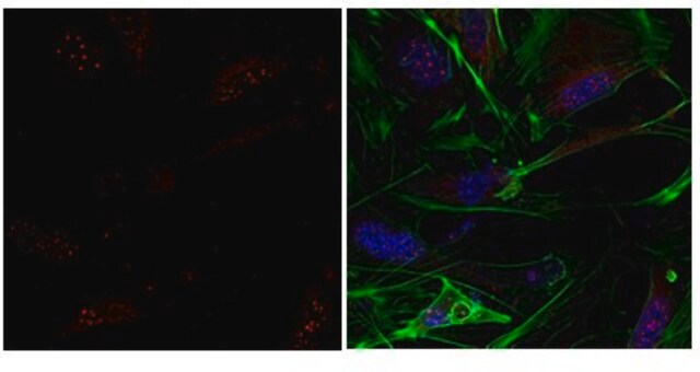 Anticorps anti-ESRRB from rabbit, purified by affinity chromatography