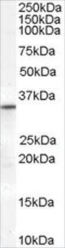 Anti-VDAC2 (Internal) antibody produced in goat affinity isolated antibody, buffered aqueous solution