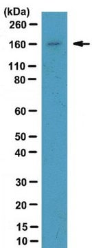 Anti-NCoA-2 Antibody from rabbit