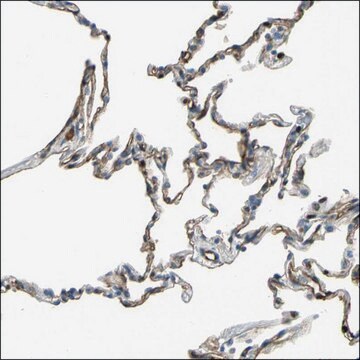 Anti-EZH1 antibody produced in rabbit Prestige Antibodies&#174; Powered by Atlas Antibodies, affinity isolated antibody, buffered aqueous glycerol solution