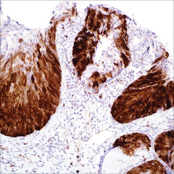 Stathmin (SP49) Rabbit Monoclonal Antibody