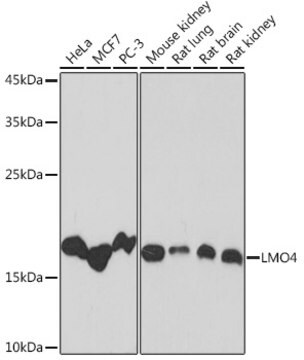 Anti-LMO4 Antibody, clone 5C0I1, Rabbit Monoclonal