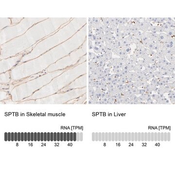 Anti-SPTB antibody produced in rabbit Ab2, Prestige Antibodies&#174; Powered by Atlas Antibodies, affinity isolated antibody, buffered aqueous glycerol solution