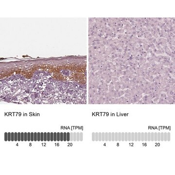 Anti-KRT79 antibody produced in rabbit Prestige Antibodies&#174; Powered by Atlas Antibodies, affinity isolated antibody, buffered aqueous glycerol solution