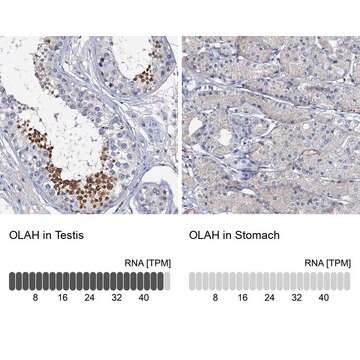 Anti-OLAH antibody produced in rabbit Prestige Antibodies&#174; Powered by Atlas Antibodies, affinity isolated antibody, buffered aqueous glycerol solution